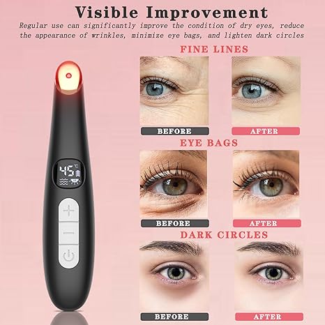 MyEboral™ 3-in-1 Eye & Face Massager